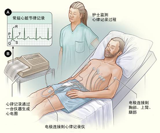 冠心病需要做哪些檢查？(圖1)